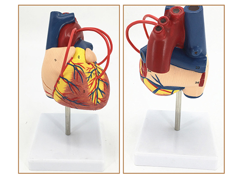 心脏搭桥模型